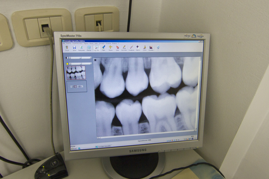 Radiografia digitale